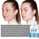 Peptide Anti-Aging Serum - Manufacturer - Wholesale BFGF AFGF EGF IGF Peptide Ampoule Face Serum