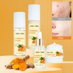 Turmeric Skin Care Set - Factory - OEM Organic Anti Acne Anti-aging Toner Serum Facial Set