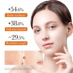 Turmeric Face Cream - Manufacturer - Wholesale Dark Spot Anti-Acne Brightening Whitening Dark Skin Cream