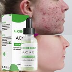 Acne Treatment Serum - Manufacturer - Custom Logo Korean Private Label Anti Acne Acne Marks Removal Face Serum