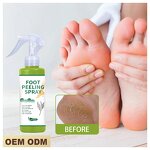 Tea Tree Foot Spray - Manufacturer - Natural Exfoliate Peel Off Remove Dead Skin Heels Black Skin Feet Care Spray