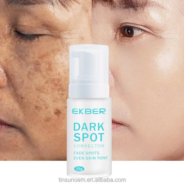 Whitening Anti Freckle Cream - Manufacturer - EKBER Bulk Organic Pigment Melasma Dark Spot Corrector Cream