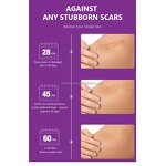 Acne Scar Removal Cream - Manufacturer - EKBER Vegan Private Label Skin Damage Repair Scar Remover Cream