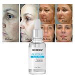 Glycolic Acid Peel Serum - Factory - Tiktok Top Sale Exfoliating Brightens Skin Glycolic Acid Solution Serum