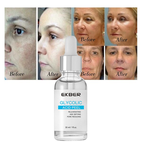 Glycolic Acid Peel Serum - Factory - Tiktok Top Sale Exfoliating Brightens Skin Glycolic Acid Solution Serum
