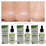 Anti-acne Facial Serum - Factory - In Stock Fast Ship Relieve Redness Swelling Shrink Pores Skin Care Serum