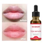 Vitamin E Lip Oil - Manufacturer - EKBER Wholesale 100% Shea Butter Non Greasy Lip Plumping Lightening Serum
