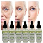 Anti-acne Facial Serum - Factory - In Stock Fast Ship Relieve Redness Swelling Shrink Pores Skin Care Serum
