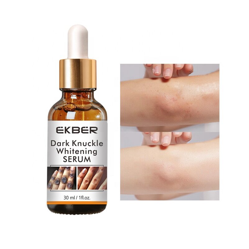 Dark Knuckle Whitening Serum - Factory - Low Moq Fast Repair Elastic Smooth Knee Knuckle Brightening Serum