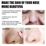 Bamboo Charcoal Soap - Manufacturer - 100% Organic Black Mud Deep Purifying Peel Off Facial Charcoal Soap