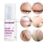 Acne Scar Removal Cream - Manufacturer - EKBER Vegan Private Label Skin Damage Repair Scar Remover Cream