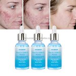 Copper Peptide Face Serum - Factory - EKBER OEM GHK-Cu Snap-8 Anti-Wrinkle Anti-Aging Moisturizing Repair