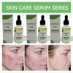 Acne Treatment Serum - Manufacturer - Custom Logo Korean Private Label Anti Acne Acne Marks Removal Face Serum