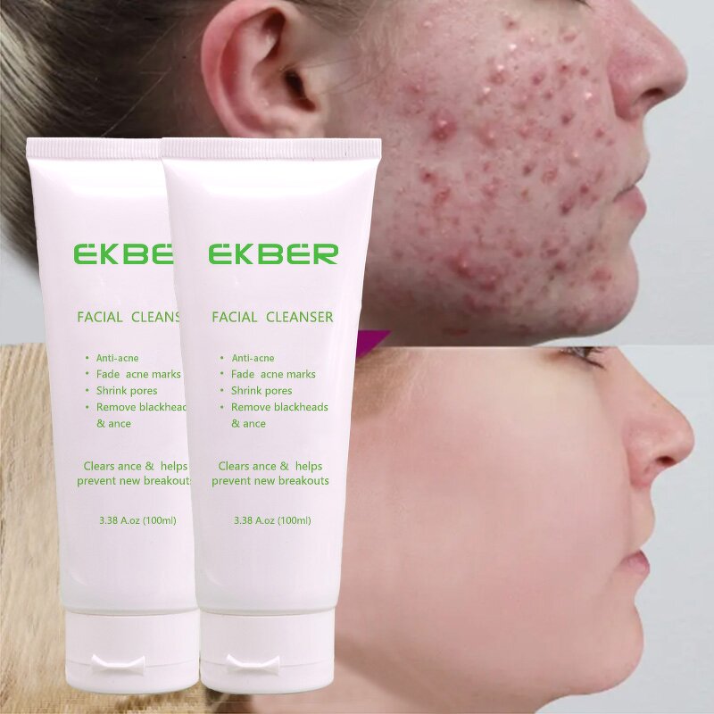 Anti Acne Facial Cleanser - Manufacturer - OEM/ODM Private Label Deep Cleansing Blackhead Removal Acne Face Wash