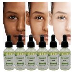 Anti-acne Facial Serum - Factory - In Stock Fast Ship Relieve Redness Swelling Shrink Pores Skin Care Serum