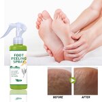 Tea Tree Foot Spray - Manufacturer - Natural Exfoliate Peel Off Remove Dead Skin Heels Black Skin Feet Care Spray