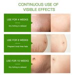 Stretch Marks Massage Oil - Factory - Private Label Natural Improve Skin Elasticity Anti Vergeture Removal Oil