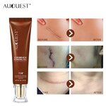 TCM Scar Removal Gel - Manufacturer - Professional Facial Acne Mark Removal Ointment South Korea Serum