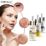 Vitamin C Hyaluronic Serum - Manufacturer - Private Label Anti Freckle Organic Anti-Aging Face Whitening Serum