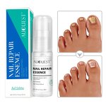 Nail Repair Spray - Factory - Wholesale New Arrival Cracked Dry Speed Growth Stronger Nail Serum