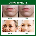 Licorice Root Serum - Manufacturer - Wholesale Private Label Organic Anti Allergy Moisturizing Sensitive Skin