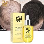 Anti Hair Loss Serum - Factory - Hot Selling Private Label Organic Herbal Scalp Repair Prevention Oil