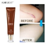 TCM Acne Scar Cream - Manufacturer - Skin Care Marks Removal Fade Gel South Korea Acne Scar Repair