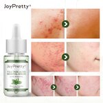 Collagen Tea Tree Set - Manufacturer - Korean Organic Anti Acne Facial Repair Moisturizing Skin Care Set