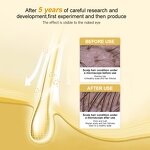 Anti Hair Loss Serum - Factory - Hot Selling Private Label Organic Herbal Scalp Repair Prevention Oil