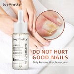 Anti Fungal Nail Serum - Factory - Herbal Repair Onychomycosis Paronychia Feet Care Nail Fungus Lotion