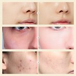 Snail Face Cream - Manufacturer - AuQuest Private Label Organic Moisturizing Collagen Whitening Anti Wrinkle