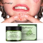 Tea Tree Acne Cream - Manufacturer - Joypretty Wholesale Organic Whitening Nourishing Anti Acne Cream
