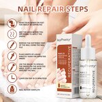 Fungal Nail Repair Serum - Manufacturer - Ready to Ship Remove Onychomycosis Toe Nourishing Nail Serum