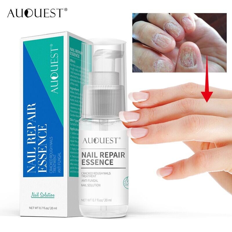 Anti Fungal Nail Serum - Factory - Private Label Repair Onychomycosis Feet Care Nail Fungus Solution
