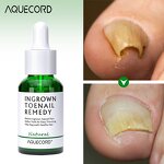 Nail Repair Oil Gel - Manufacturer - Private Label Anti Infection Paronychia Onychomycosis Feet Care Gel