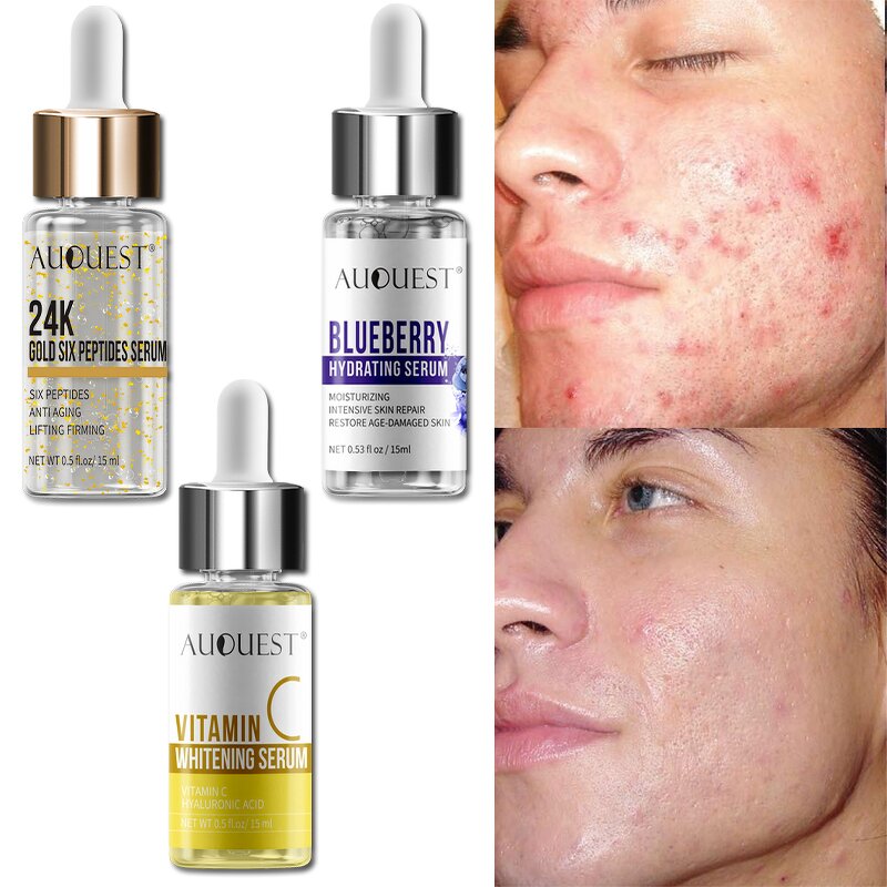 Vitamin C Hyaluronic Serum - Factory - OEM Hot Selling Private Label Whitening Anti Aging Beauty Care Serum