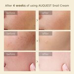 Snail Face Cream - Manufacturer - AuQuest Private Label Organic Moisturizing Collagen Whitening Anti Wrinkle