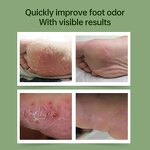 Foot Deodorizer Spray - Manufacturer - Wholesale Eliminates Foot Fungus Prevents Odors Shoe Deodorizer