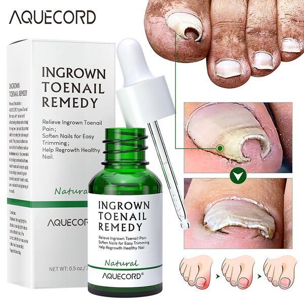 Nail Repair Oil Gel - Manufacturer - Private Label Anti Infection Paronychia Onychomycosis Feet Care Gel