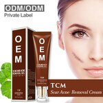 TCM Acne Scar Gel - Factory - Best Herbal Extracts Stretch Marks Scar Clearing Products Wholesale