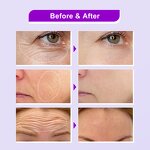 Retinol Bakuchiol Serum - Factory - Wholesale 3% Organic Anti Aging Reduce Fine Line Anti Wrinkle Serum