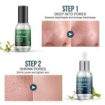 Blackhead Removal Serum - Factory - AuQuest Private Label Organic Pore Cleanser Whitening Dark Spot Serum