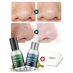 Blackhead Removal Serum - Factory - AuQuest Private Label Organic Pore Cleanser Whitening Dark Spot Serum