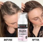 Hair Growth Oil Manufacturer - Hot Selling Biotin Fast Repair Anti Loss