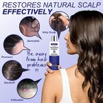 Anti-Dandruff Shampoo Manufacturer - Herbal Anti-Fungal for Dry Scalps