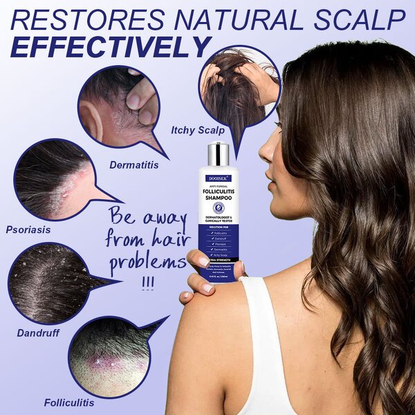 Anti-Dandruff Shampoo Manufacturer - Herbal Anti-Fungal for Dry Scalps