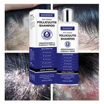 Anti-Dandruff Shampoo Manufacturer - Deep Cleaning for Folliculitis & Psoriasis