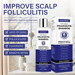 Scalp Care Shampoo Manufacturer - 250ml Daily Use Organic Anti-Fungal Lotion