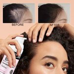 Hair Regrowth Gel Manufacturer - 5% Redensyl Rosemary for Thickening & Density