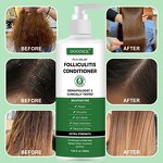 Scalp Psoriasis Shampoo Manufacturer - Spot Product with Tea Tree Oil for Relief